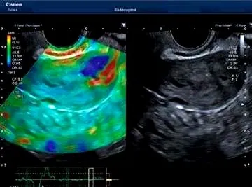 Fizjoterapeuta a ultrasonografia: czy to możliwe?