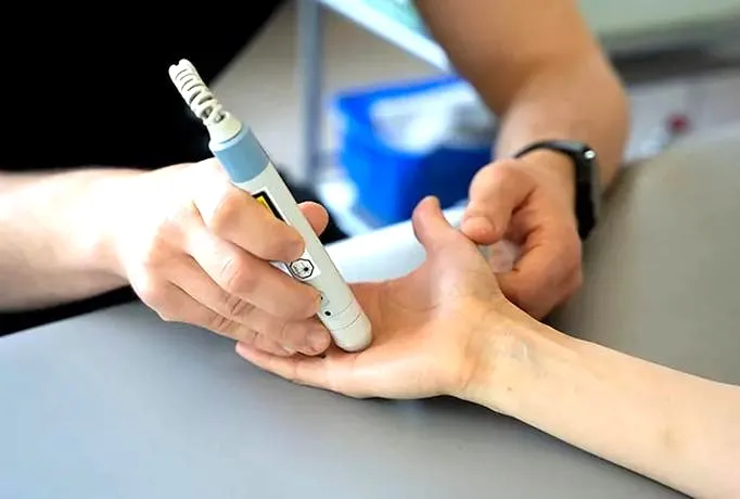 Rehabilitacja po zabiegu cieśni nadgarstka – jak skutecznie wrócić do zdrowia?
