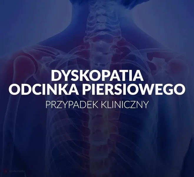 Dyskopatia objawy