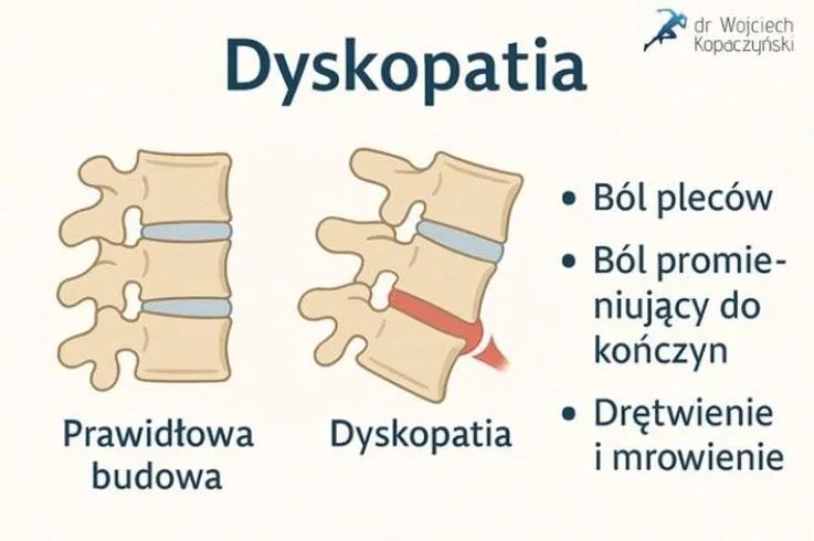 Rehabilitacja kręgosłupa