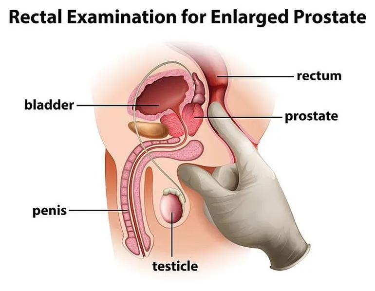 Techniki masażu prostaty
