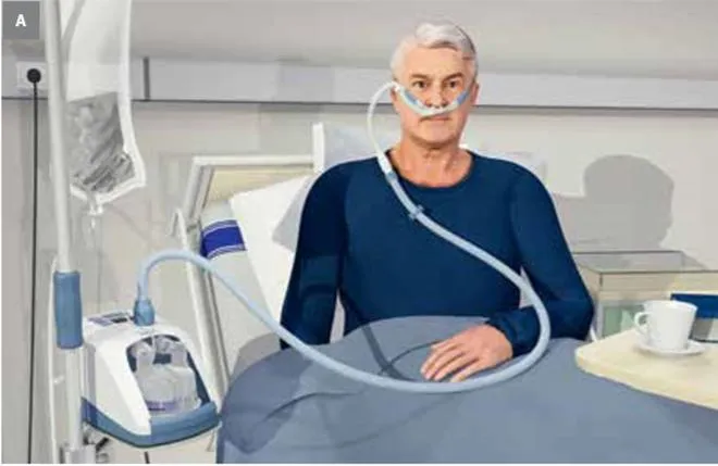 Tlenoterapia medycyna estetyczna