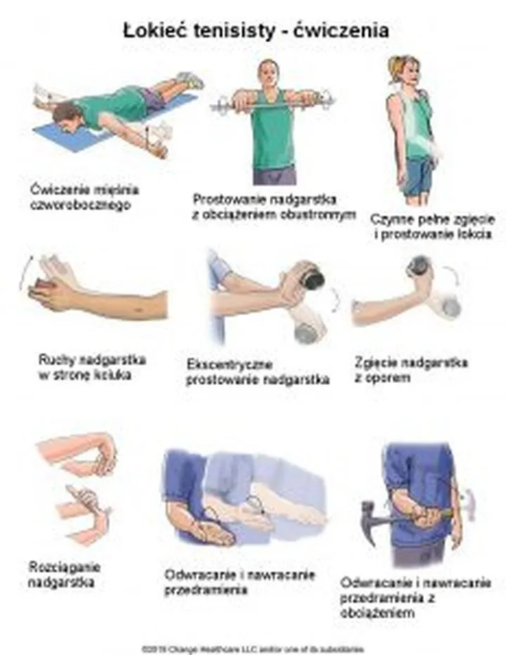 Wczesna rehabilitacja łokcia